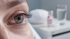 4-steps-to-make-your-eyes-white-naturally-after-cataract-surgery