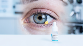 7-essential-pinguecula-eye-drops-for-effective-relief