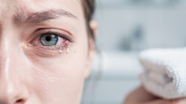blepharitis-treatment-comparing-antibiotics-and-alternatives