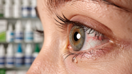 compare-eye-drops-for-corneal-abrasion-otc-vs-prescription-options