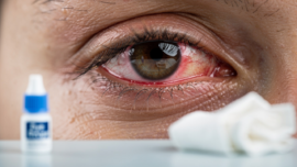essential-corneal-ulcer-self-care-practices-for-better-recovery