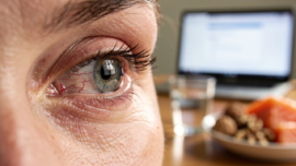 how-to-cure-dry-eyes-permanently-and-naturally-a-step-by-step-guide