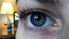 how-to-treat-dry-eye-a-step-by-step-relief-guide