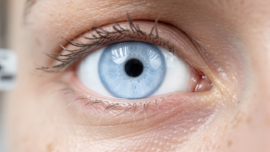 is-blue-sclera-dangerous-understanding-causes-and-risks