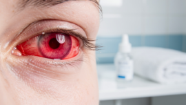 pink-eye-vs-eye-infection-symptoms-treatments-and-prevention