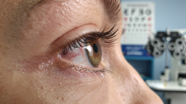 understanding-a-scratch-on-eyeball-causes-symptoms-and-care