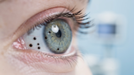 understanding-black-spots-on-the-eyeball-causes-treatments-and-signs