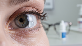 understanding-eye-bubbles-on-the-white-area-causes-and-care
