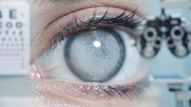 understanding-hypermature-cataracts-symptoms-treatments-and-surgery