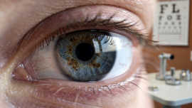 understanding-melanosis-eye-symptoms-causes-and-treatments