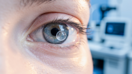 understanding-the-eye-bubble-causes-diagnosis-and-treatment