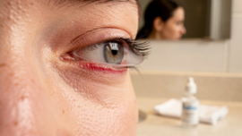 what-happens-when-contacts-go-behind-your-eye